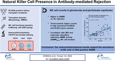 Natural Killer Cell Presence in Antibody-Mediated Rejection